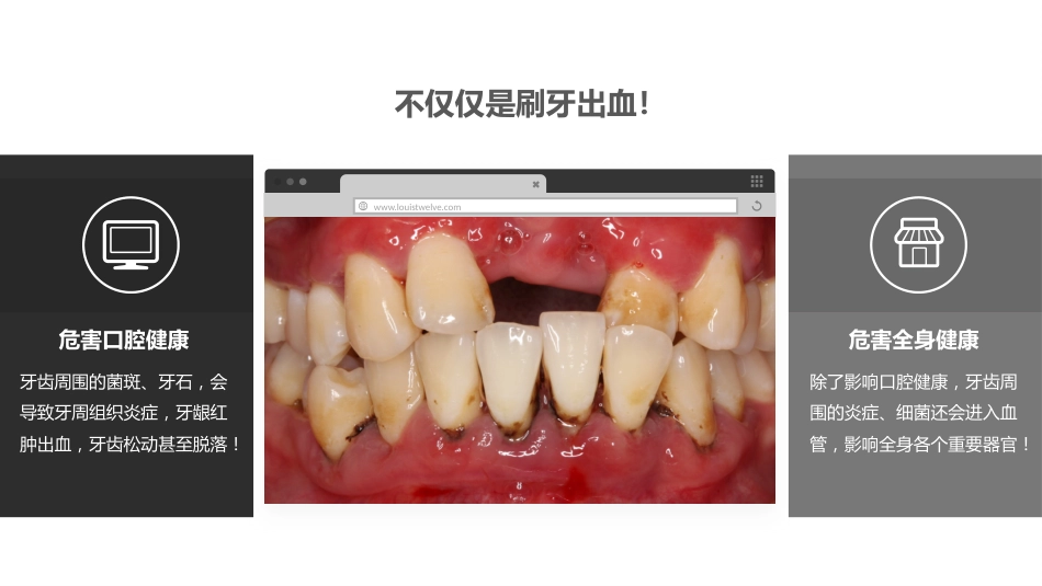 口腔培训115.为什么要洁牙（医生版）_第2页