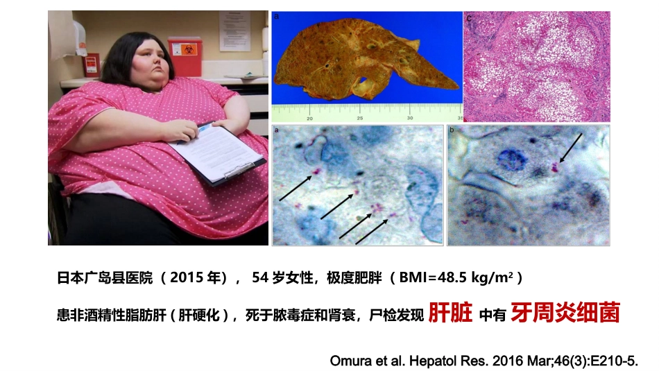 口腔培训115.为什么要洁牙（医生版）_第8页