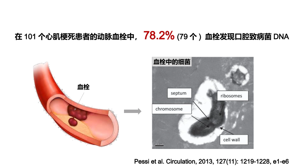 口腔培训115.为什么要洁牙（医生版）_第9页