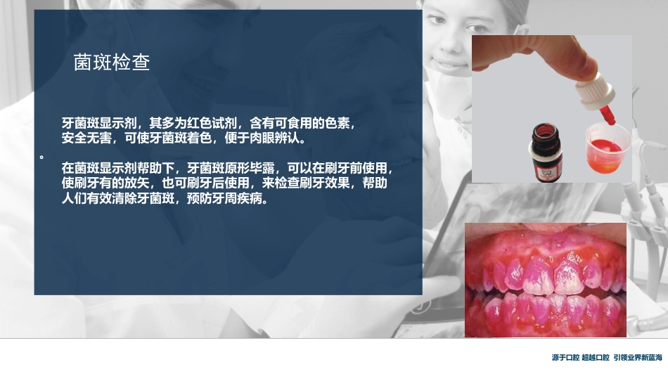 口腔培训117.牙周治疗_第4页