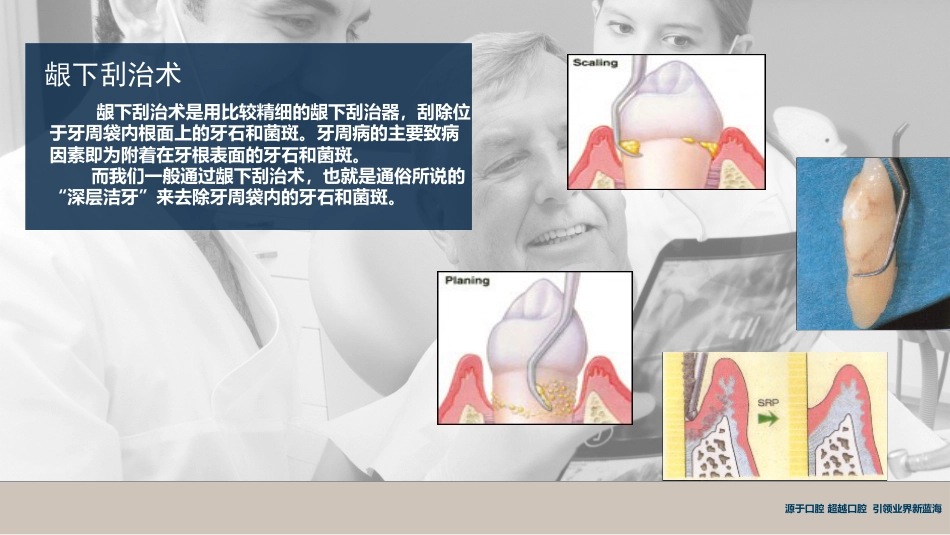 口腔培训117.牙周治疗_第8页