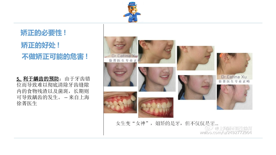 口腔培训123.诊所经理口腔专业培训之正畸课件_第10页