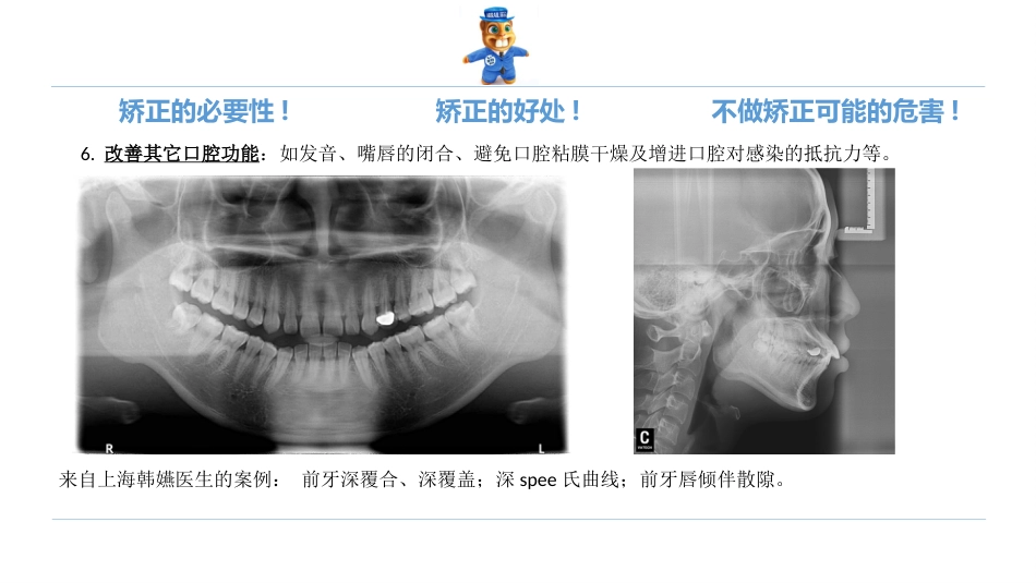 口腔培训123.诊所经理口腔专业培训之正畸课件_第11页