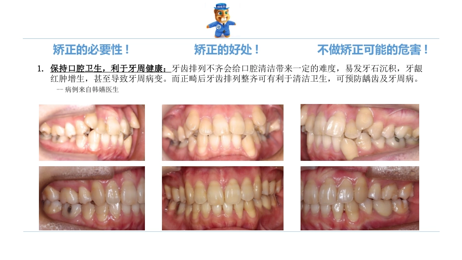 口腔培训123.诊所经理口腔专业培训之正畸课件_第4页