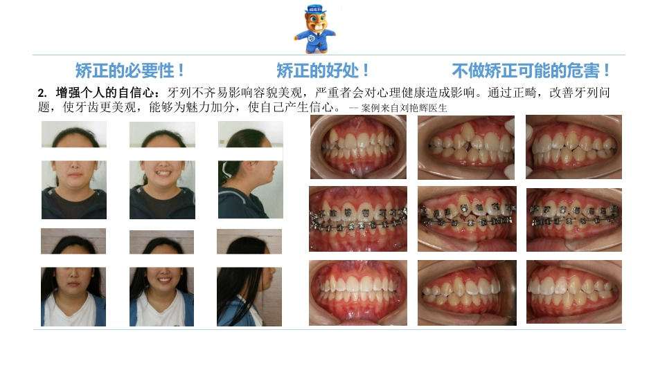 口腔培训123.诊所经理口腔专业培训之正畸课件_第5页