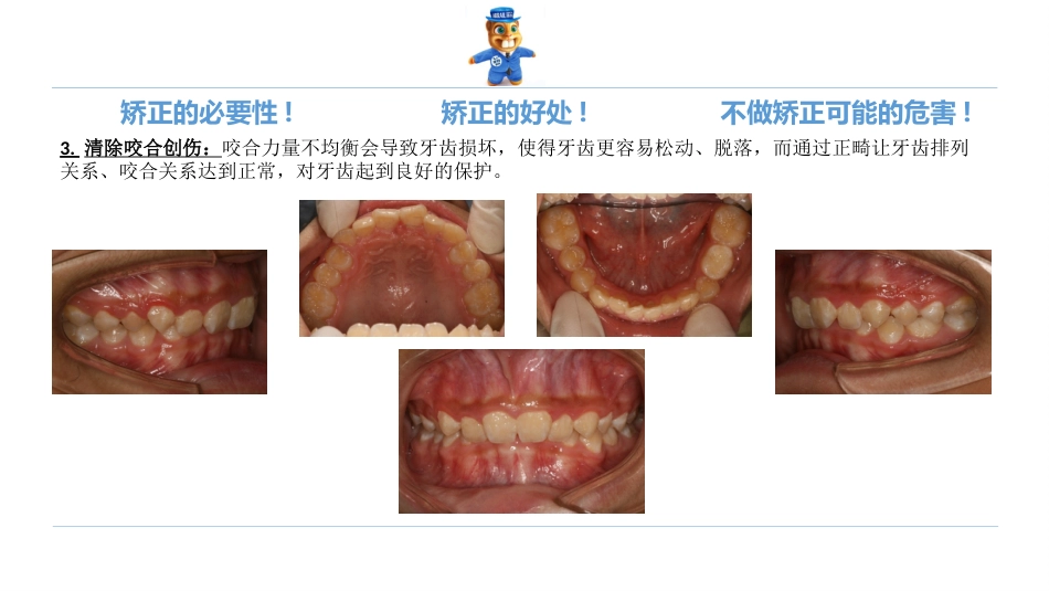 口腔培训123.诊所经理口腔专业培训之正畸课件_第6页