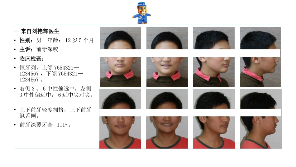 口腔培训123.诊所经理口腔专业培训之正畸课件_第8页