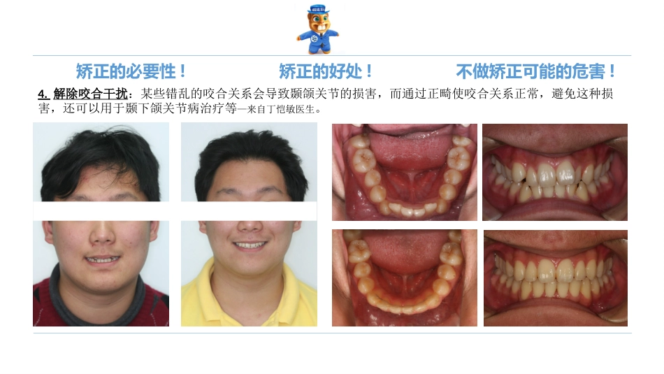 口腔培训123.诊所经理口腔专业培训之正畸课件_第9页