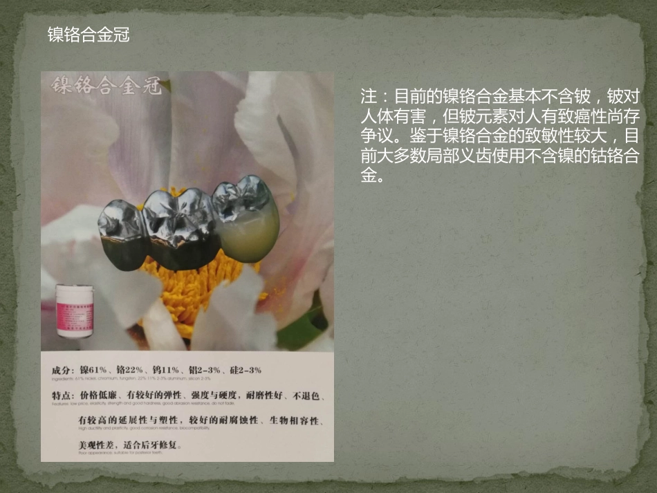 口腔培训125.金属冠对口腔影像的影响_第14页