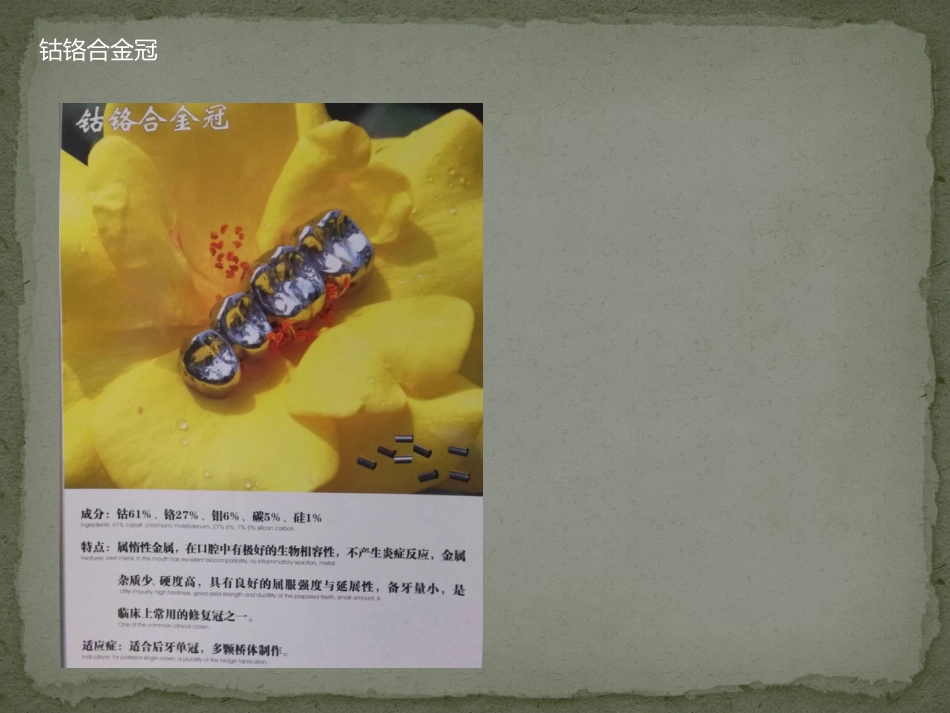 口腔培训125.金属冠对口腔影像的影响_第15页