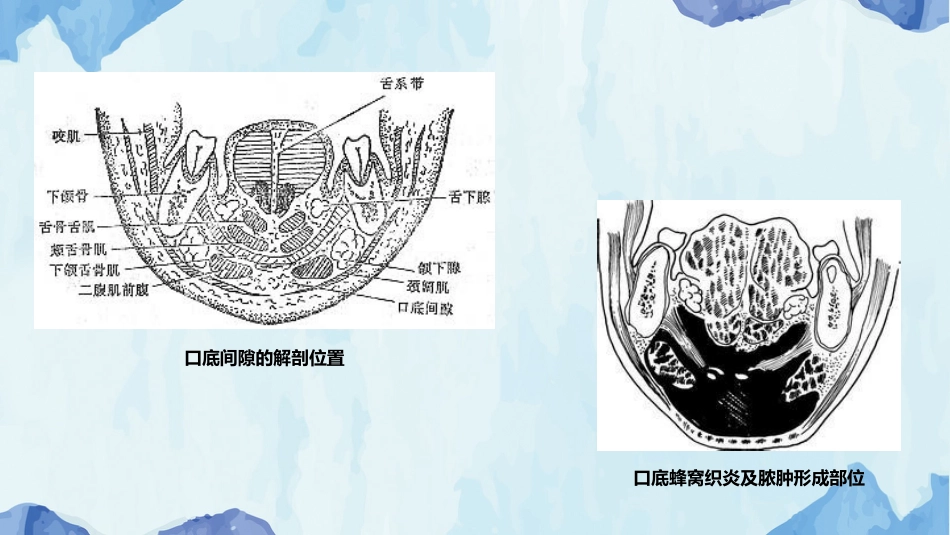 口腔培训127.颌面部肿胀_第8页