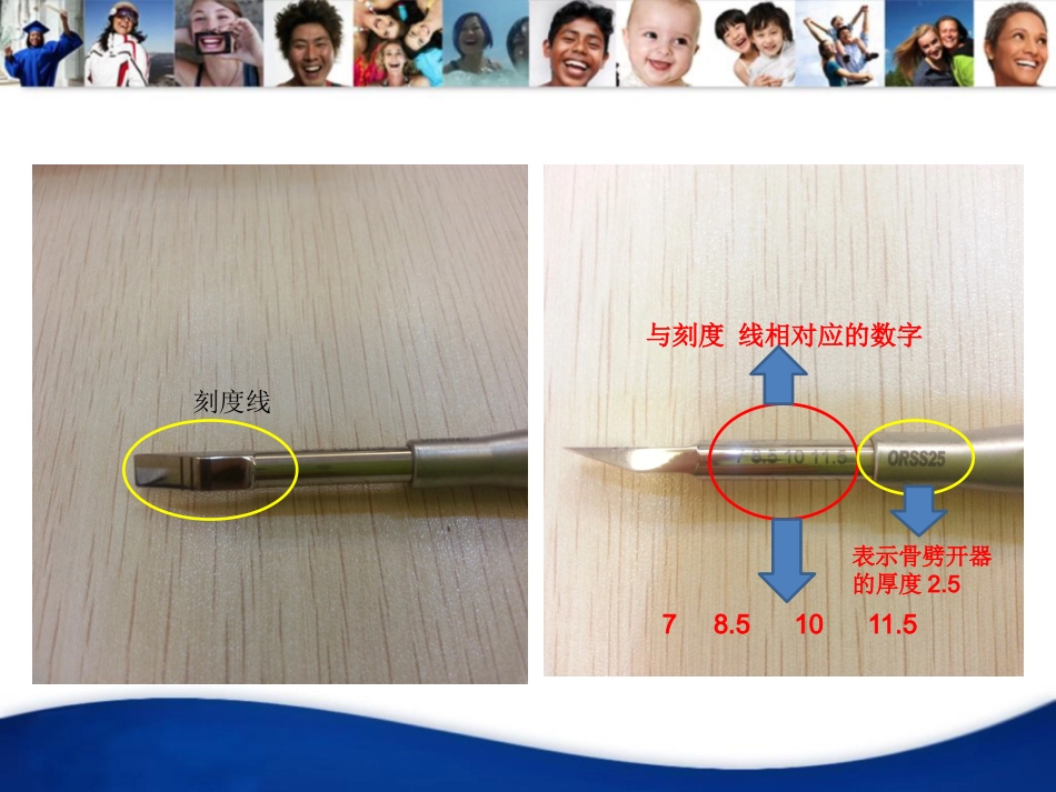 口腔培训128.骨劈开手术_第7页