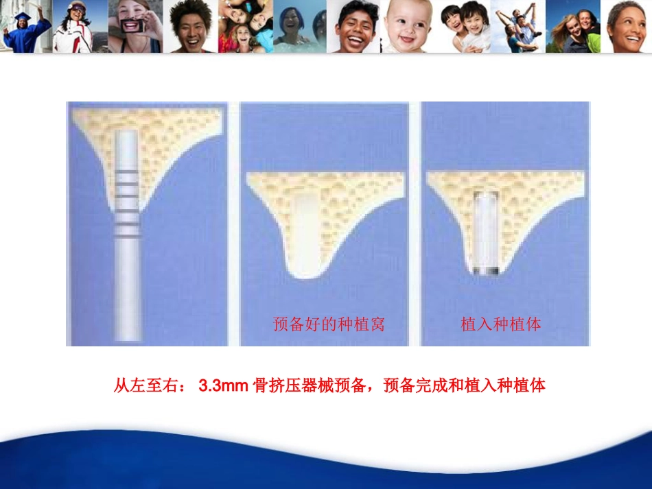口腔培训130.骨挤压_第10页