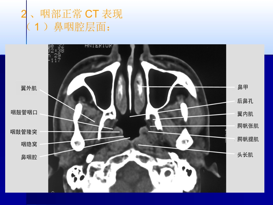 咽喉影像诊断学_第9页