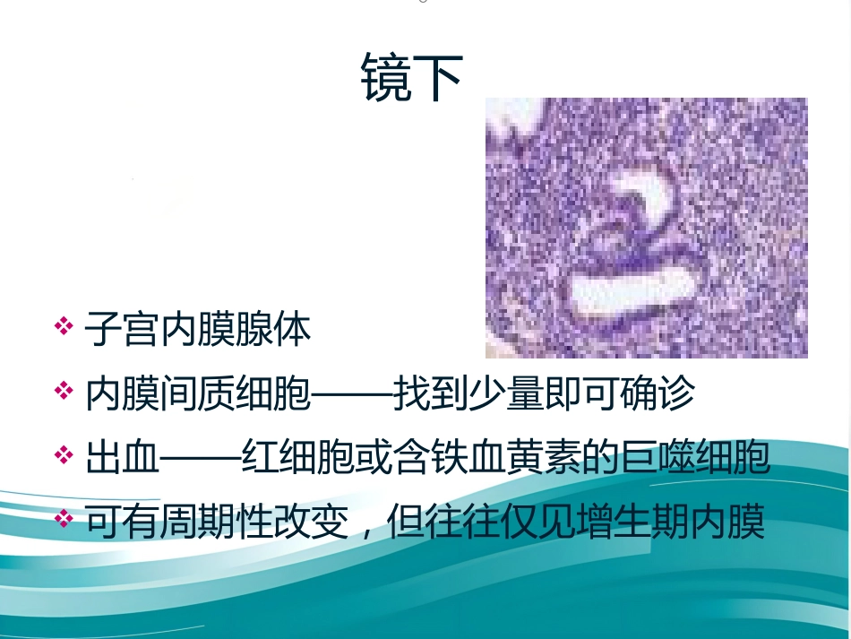 子宫内膜异位症影像诊断_第9页