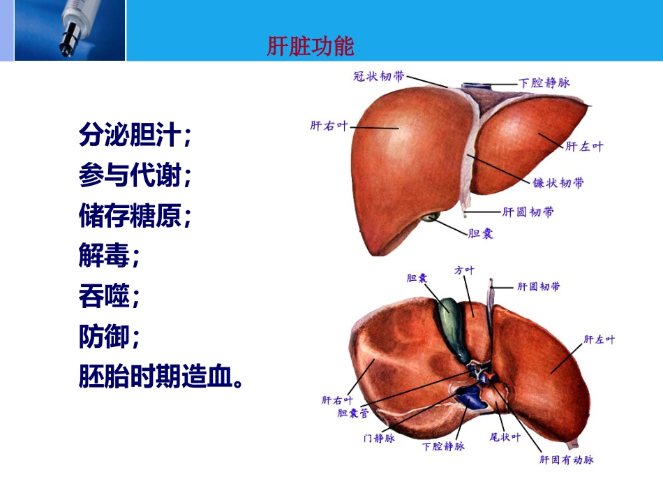肝脏的CT影像诊断_第3页
