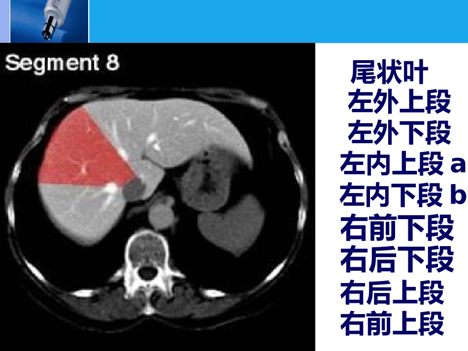 肝脏的CT影像诊断_第8页