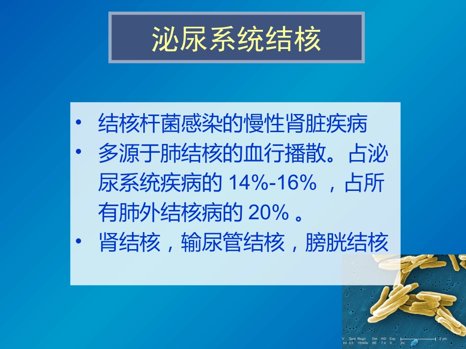 泌尿系统感染影像诊断_第2页