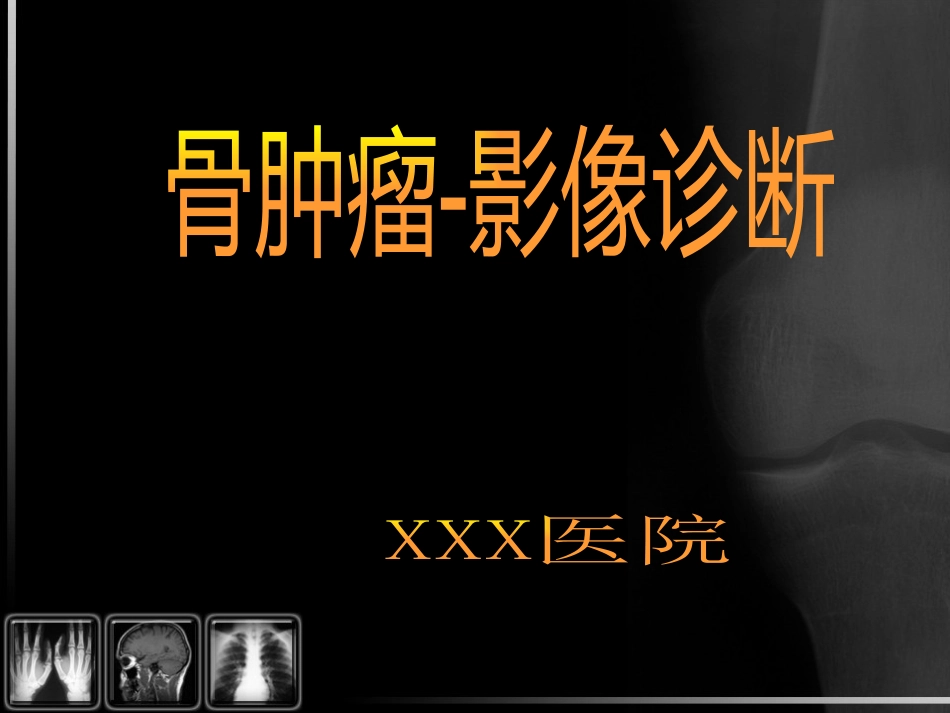 骨肿瘤影像诊断_第1页
