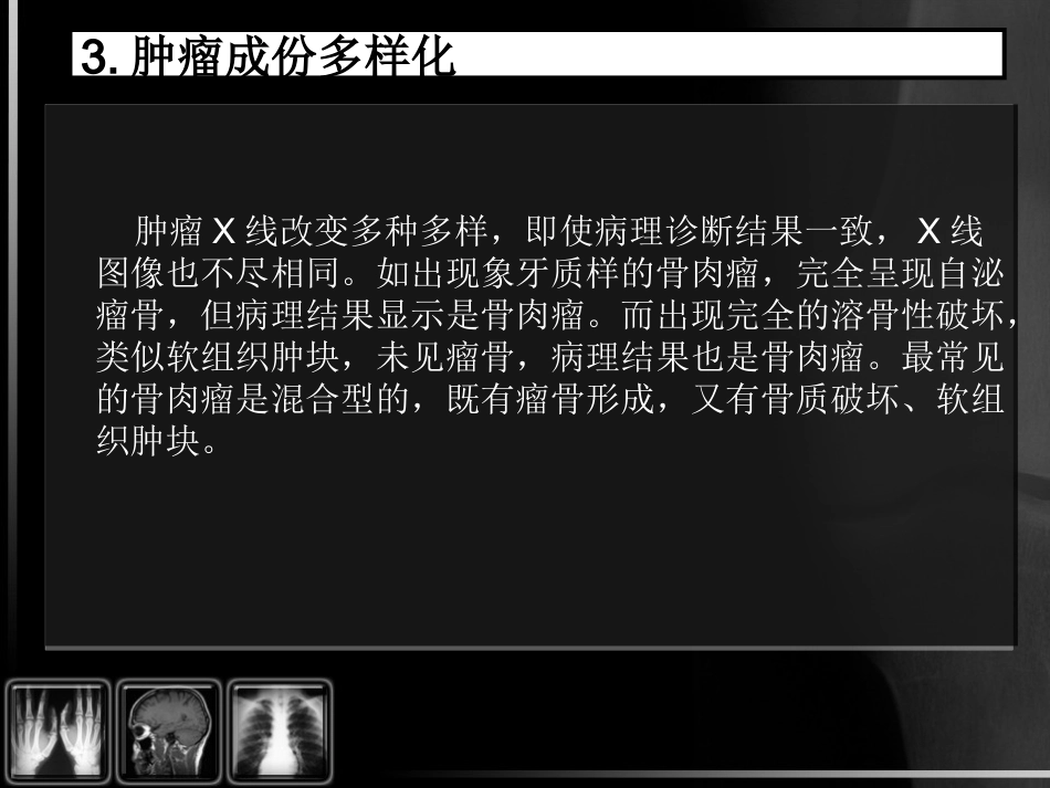 骨肿瘤影像诊断_第10页