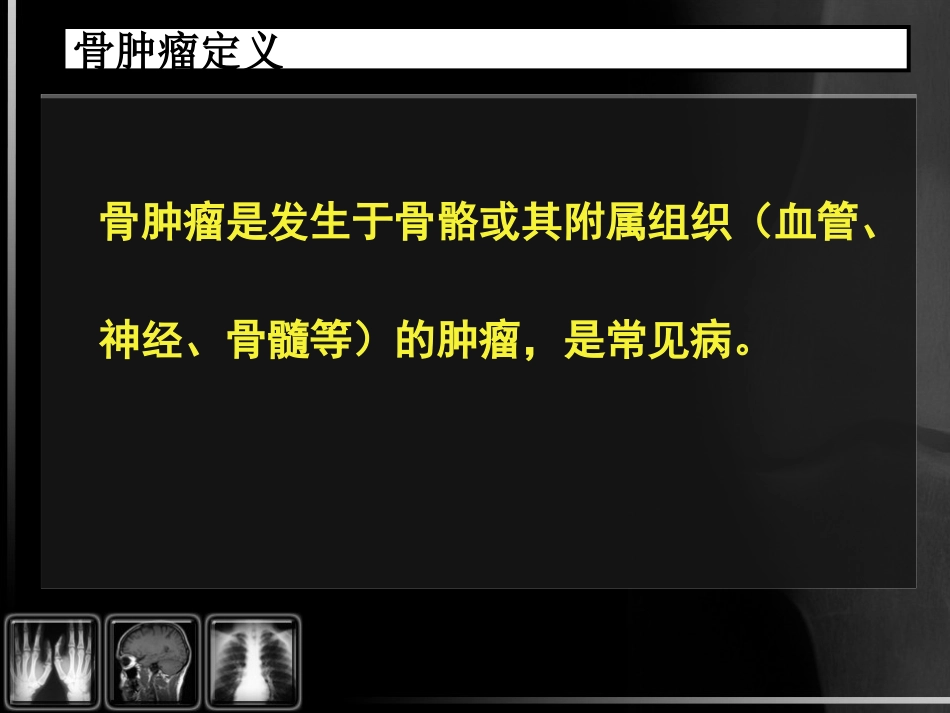骨肿瘤影像诊断_第2页