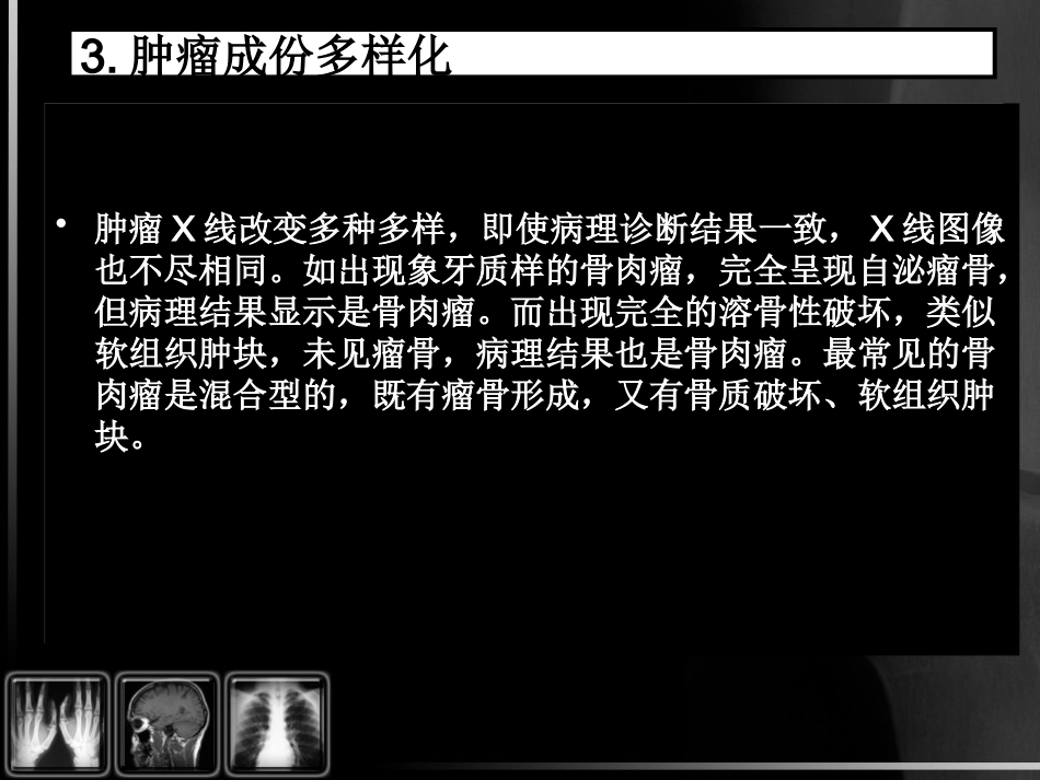 骨肿瘤影像诊断_第7页