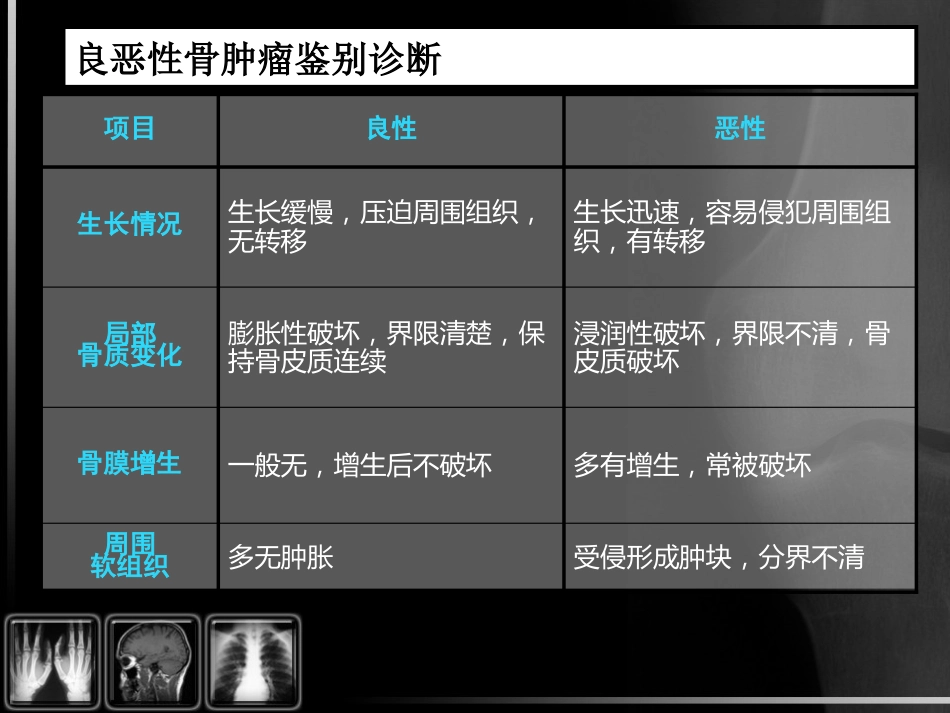骨肿瘤影像诊断_第9页