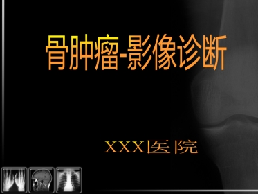 骨肿瘤影像诊断