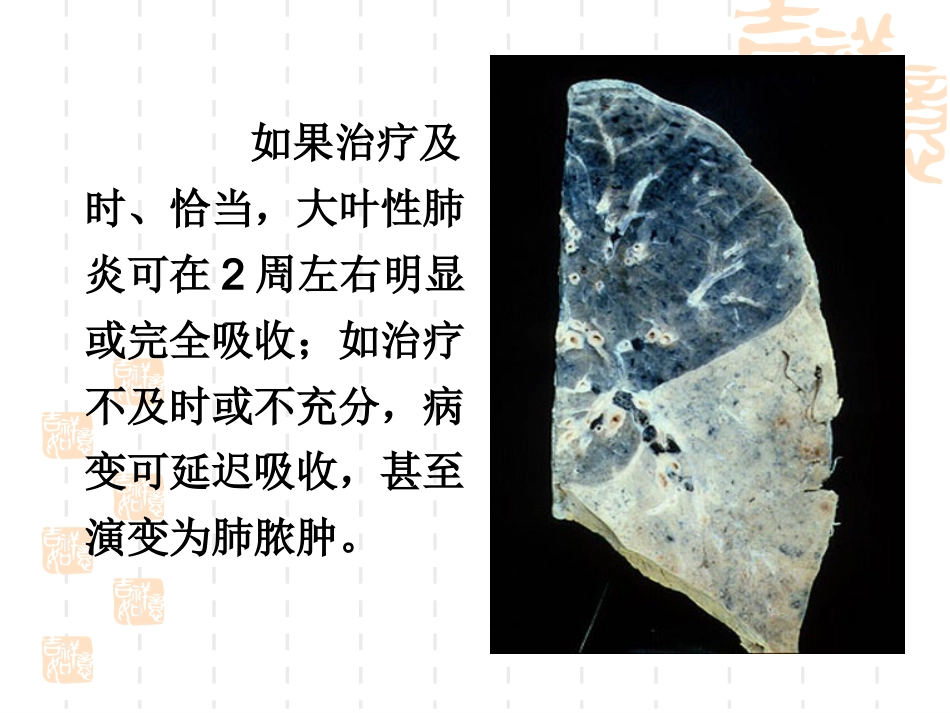肺部常见疾病的影像诊断_第8页