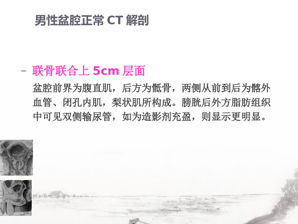 男性生殖系统疾病影像诊断_第11页