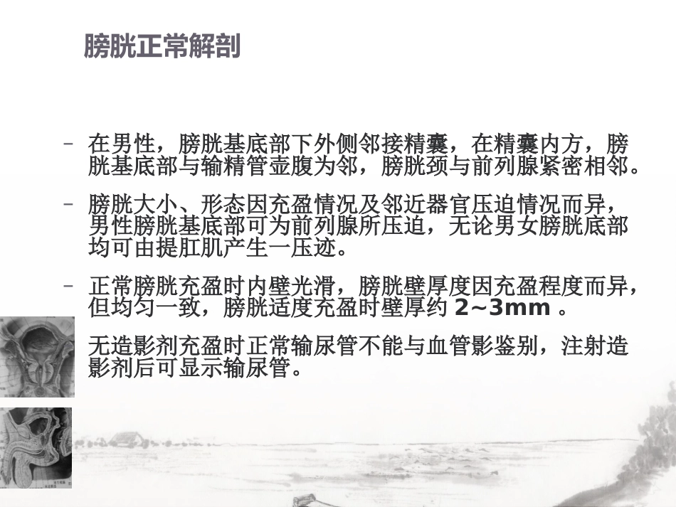 男性生殖系统疾病影像诊断_第14页