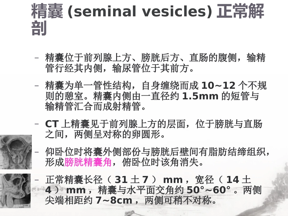 男性生殖系统疾病影像诊断_第15页