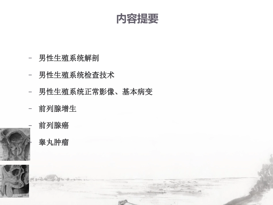 男性生殖系统疾病影像诊断_第2页