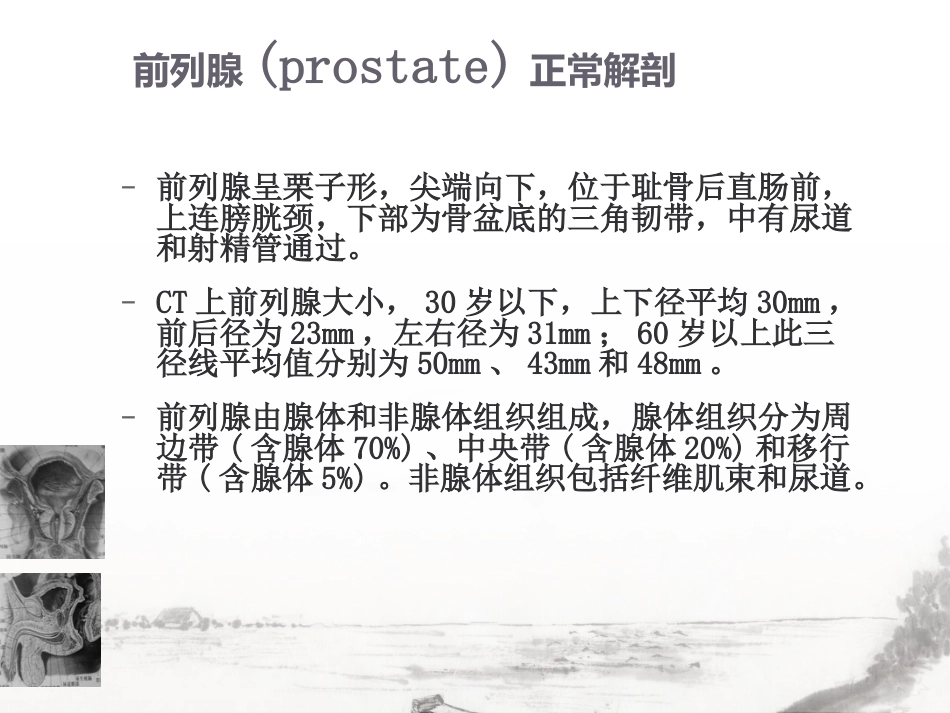 男性生殖系统疾病影像诊断_第5页