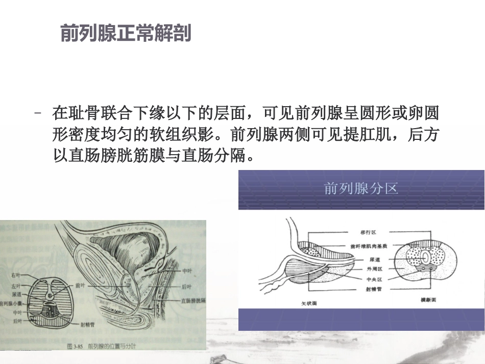 男性生殖系统疾病影像诊断_第6页
