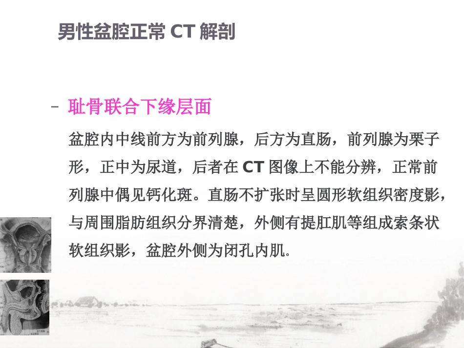 男性生殖系统疾病影像诊断_第8页
