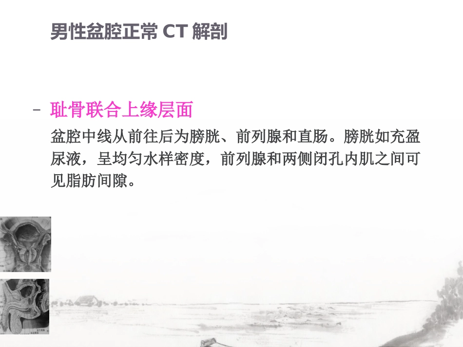 男性生殖系统疾病影像诊断_第9页