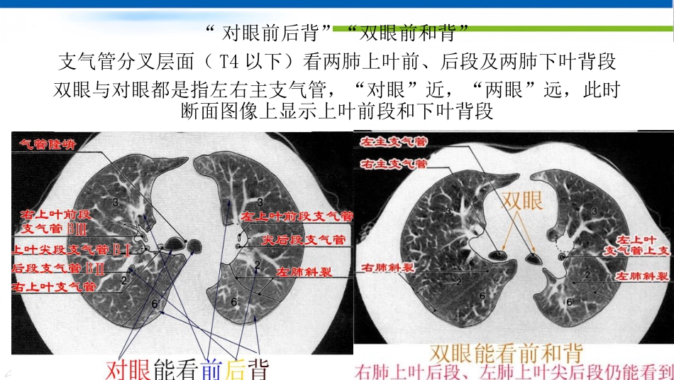 肺不张影像浅见_第5页