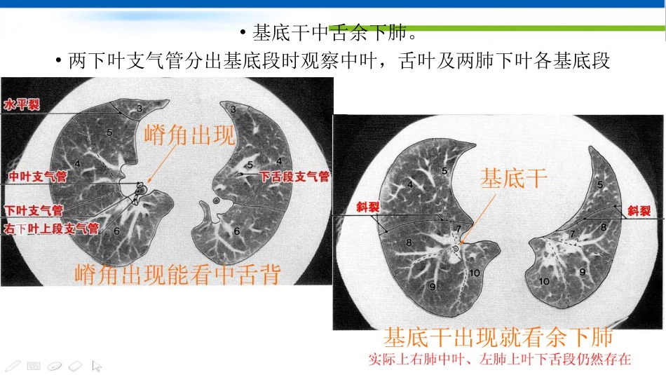 肺不张影像浅见_第6页