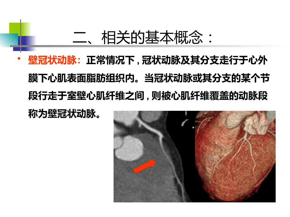 64排CT 对冠状动脉心肌桥的影像学评价_第7页