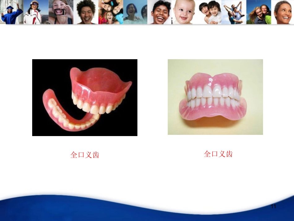 老年人口腔知识宣教资料PPT_第11页