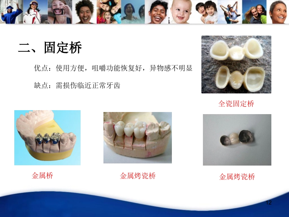 老年人口腔知识宣教资料PPT_第12页