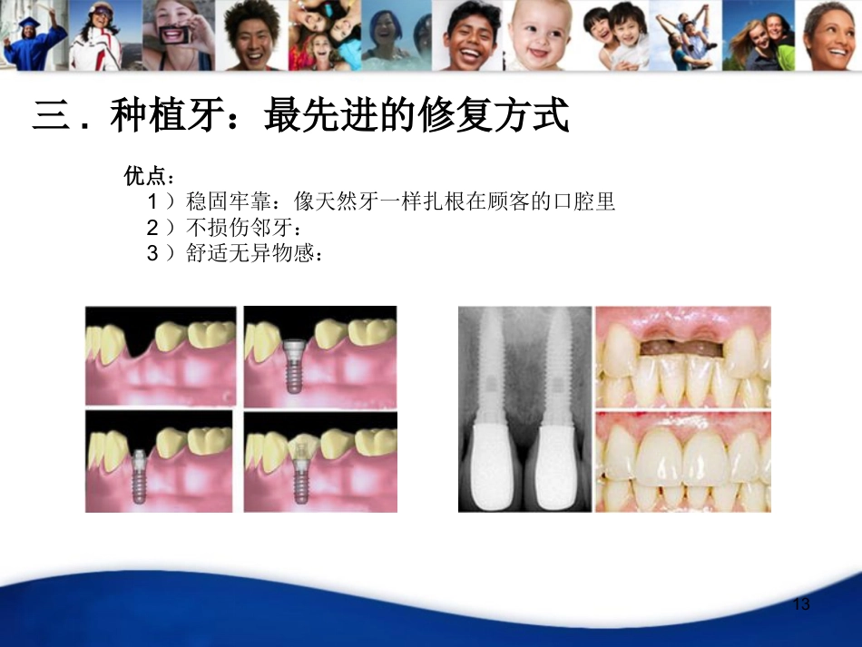 老年人口腔知识宣教资料PPT_第13页