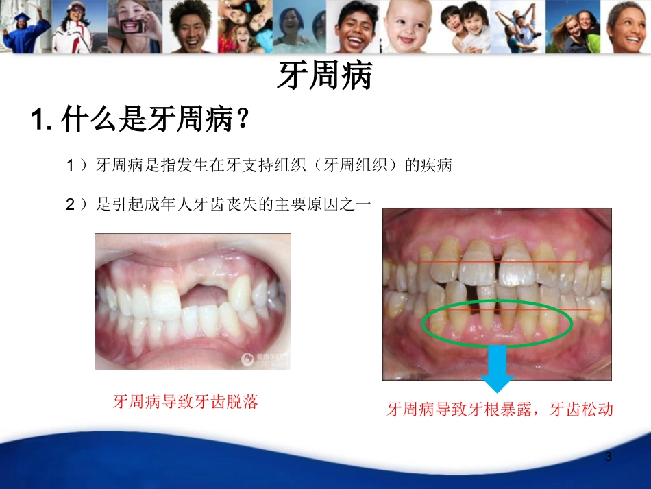 老年人口腔知识宣教资料PPT_第3页