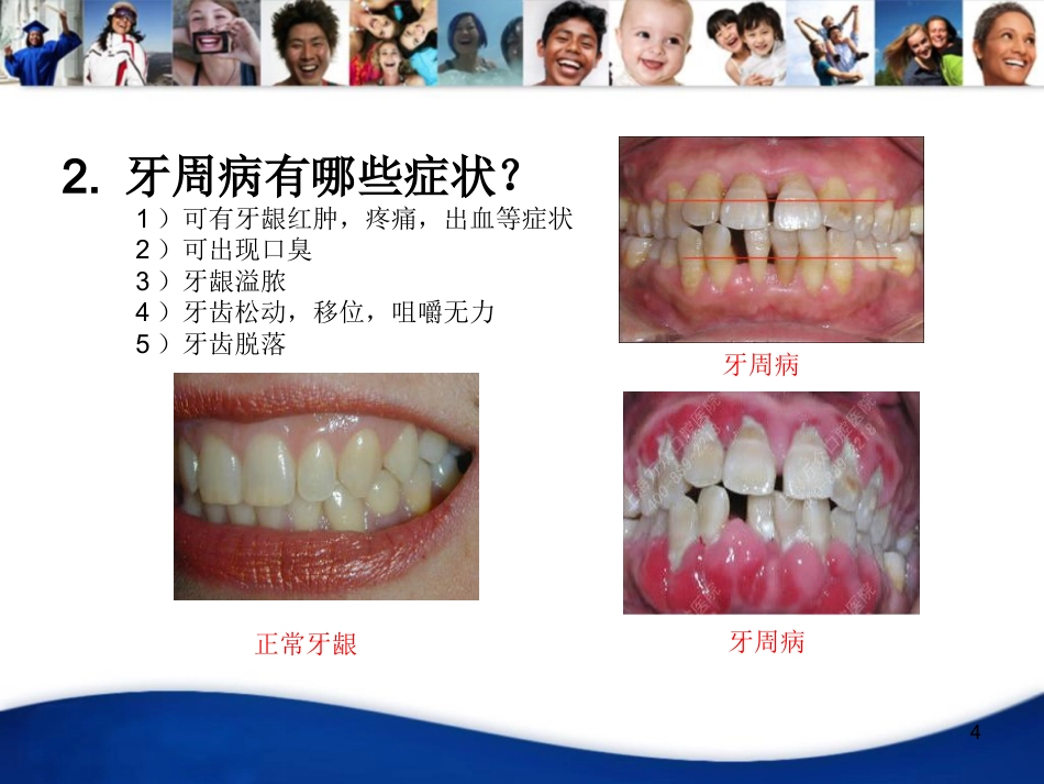 老年人口腔知识宣教资料PPT_第4页