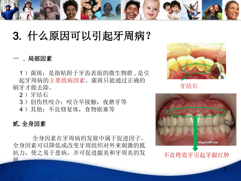 老年人口腔知识宣教资料PPT_第5页