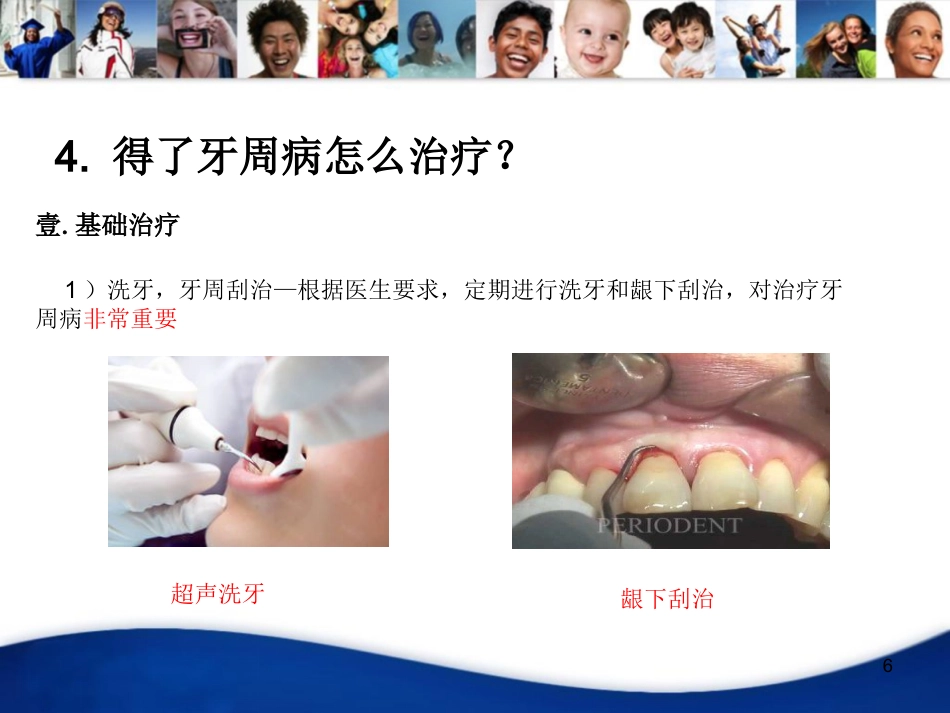 老年人口腔知识宣教资料PPT_第6页
