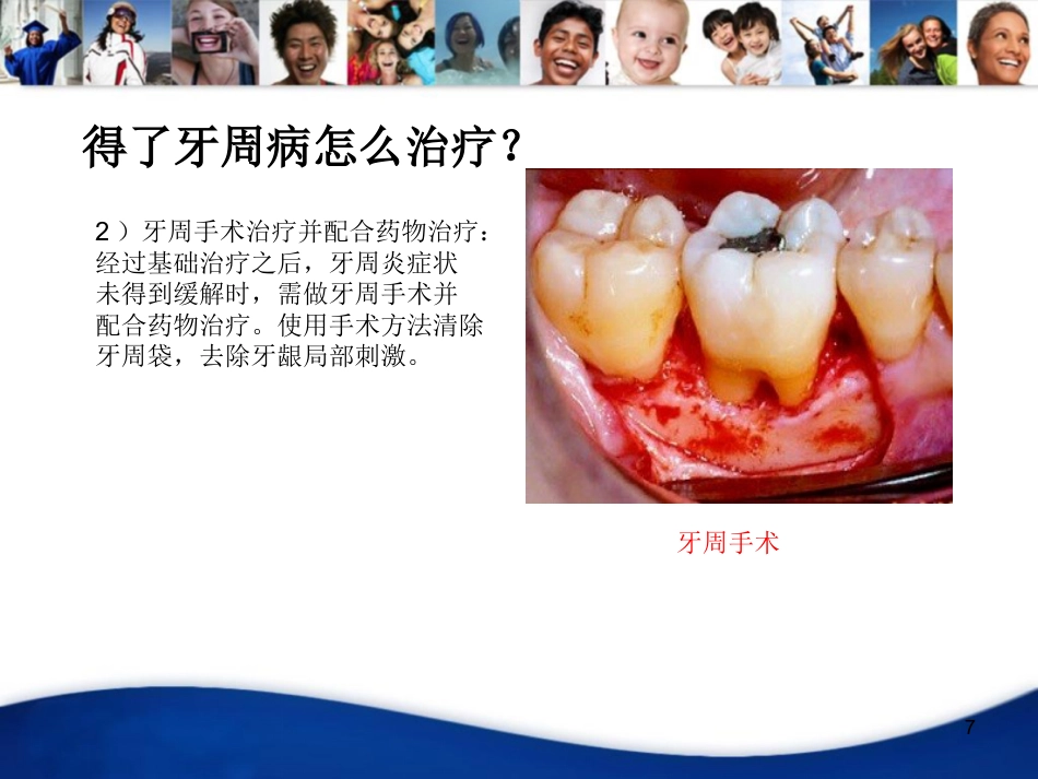 老年人口腔知识宣教资料PPT_第7页