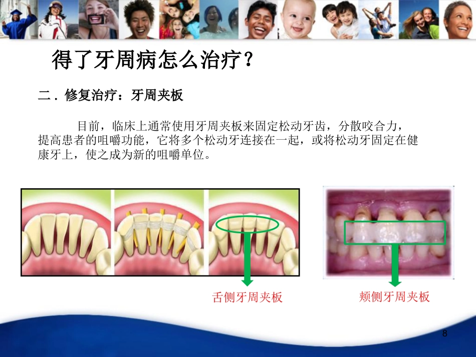 老年人口腔知识宣教资料PPT_第8页