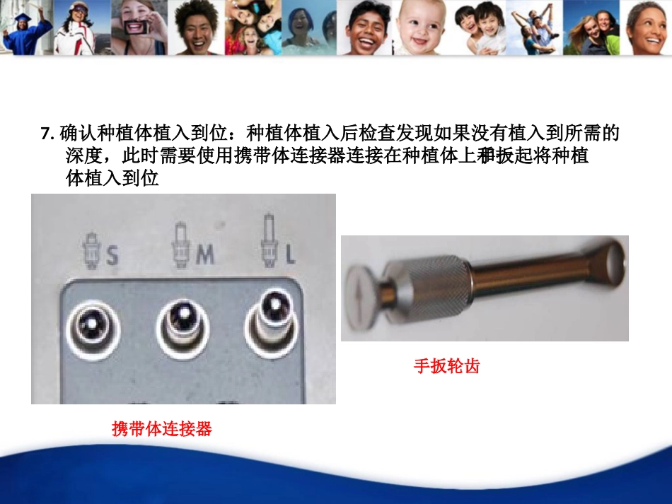 ANKYLOS种植一期盒_第12页